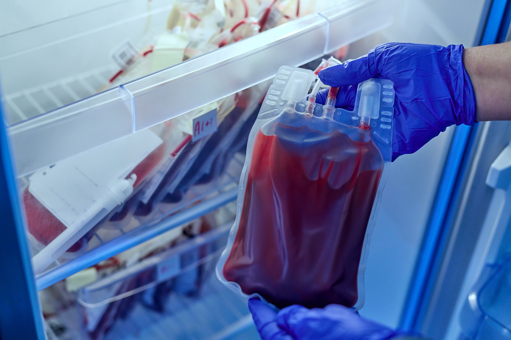 doctor holding a bag of red blood in the blood storage refrigerator in the laboratory